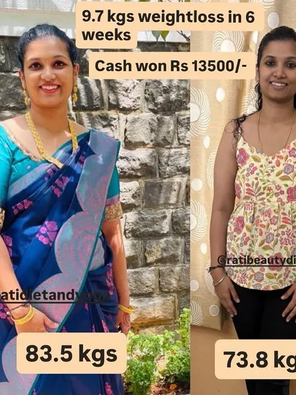 Before and after of Reshma, who lost 9.7 kgs and won Rs 13,500.