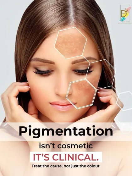This is the core of my philosophy. Pigmentation is a clinical condition, not just a cosmetic concern. Whether it's caused by sun exposure, hormones, or inflammation, I always focus on treating the root cause to achieve lasting clarity.
