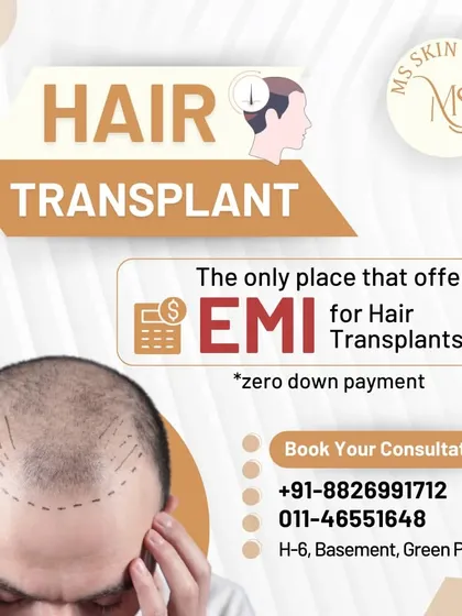I believe that financial constraints should not stop you from regaining your confidence. To make the permanent solution of a hair transplant more accessible, I offer flexible EMI options with zero down payment.