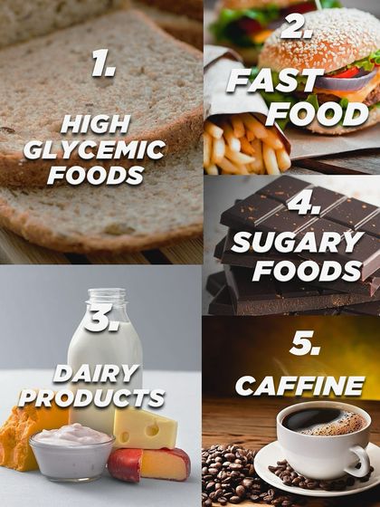 An infographic on foods that can trigger acne, such as high glycemic foods, dairy, and sugar. A healthy diet is part of good skincare.