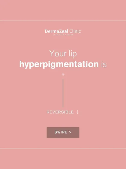 Good news: your lip hyperpigmentation is reversible. With the right treatment plan, we can work to restore the natural color and health of your lips.