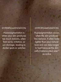 Pigmentation & Skin Brightening