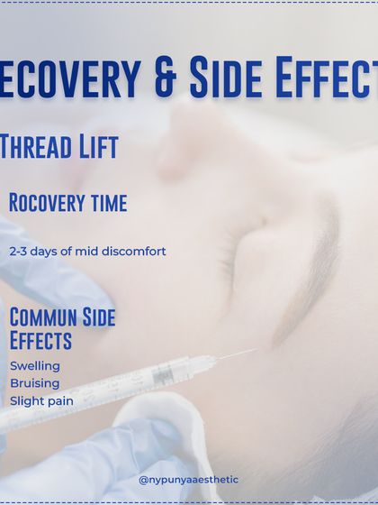 Recovery from a thread lift is minimal, usually involving 2 to 3 days of mild discomfort. Common side effects include temporary swelling, bruising, and slight pain, which resolve quickly.