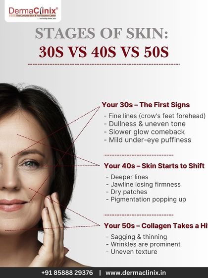 This infographic details the common signs of aging at different stages of life, from fine lines in your 30s to sagging and prominent wrinkles in your 50s. Understanding these changes helps in creating an effective treatment plan.