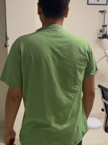 The "after" shot of Mr. Deepak, showing a relaxed and more balanced shoulder posture, free from the stiffness that previously troubled him.