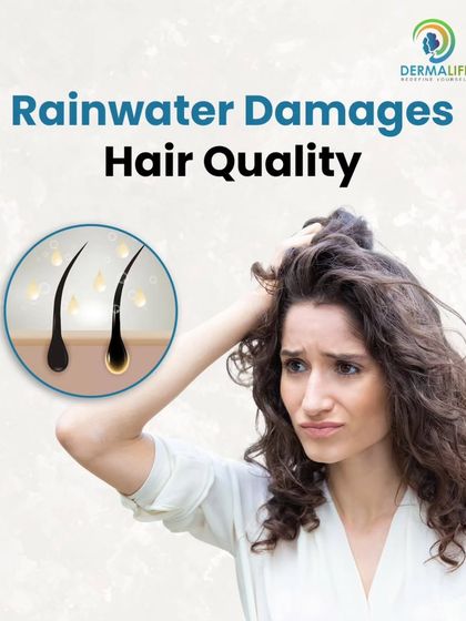 Rainwater can damage hair quality, making it more prone to breakage and fall during the monsoon.