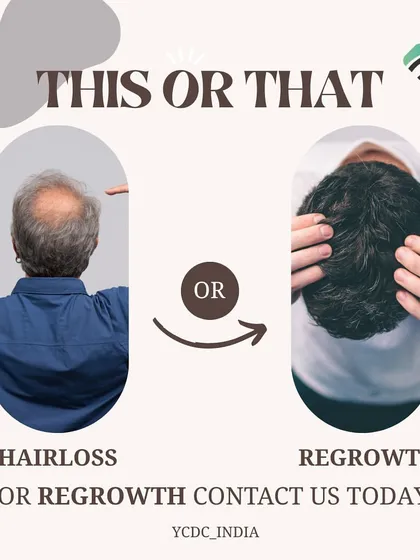 A simple but effective choice: hair loss or regrowth. I provide advanced hair transplant treatments to help you choose regrowth and transform your life.