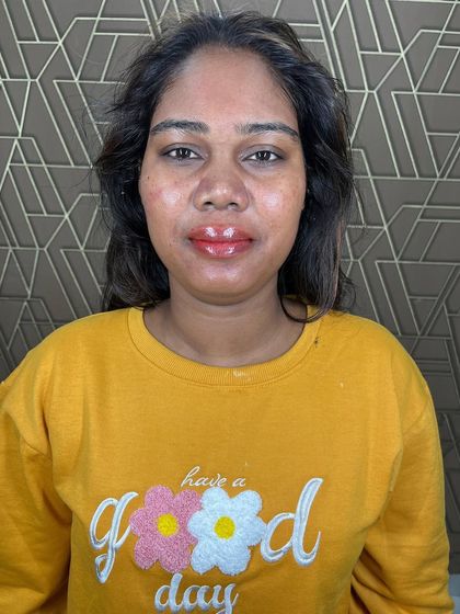 This client is all smiles, showing off her freshly blushed lips. The treatment gave her a beautiful, natural tint that brightens her entire face.