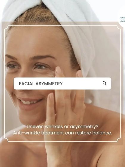 Facial asymmetry, where one side has more wrinkles or less volume than the other, can be corrected with strategically placed anti-wrinkle treatments and fillers to restore a sense of balance.