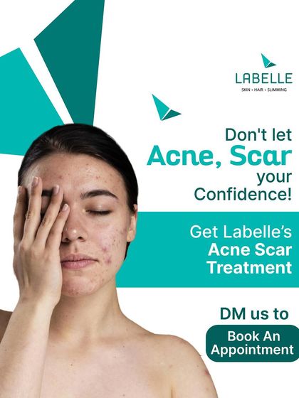 LaBelle - Advanced Skin & Facial Treatments Acne & Scar Transformations photo 4