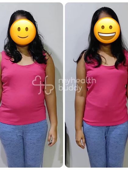 Front view of the 6kg loss, showing a much healthier and fresher look.