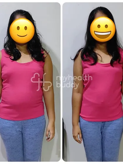 This client lost 6 kgs in 3 months by overcoming a sedentary lifestyle. Her front view shows a clear reduction in overall body fat.