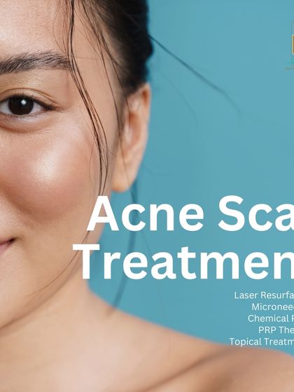 Treating acne scars is not a one-size-fits-all process. I offer a range of effective treatments including Laser Resurfacing, Microneedling, Chemical Peels, and PRP Therapy. The right combination is selected after a thorough analysis of your scar type and skin condition.
