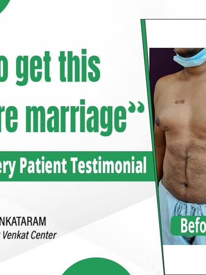 The Venkat Center - Plastic Surgery for Face & Body Awake Gynecomastia Surgery photo 24