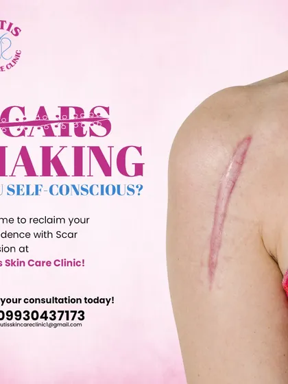 Scars from surgery or injury can be a source of self-consciousness. We offer advanced scar revision treatments designed to improve the texture and appearance of scars, helping to restore smoother skin on areas like the shoulder and arm.