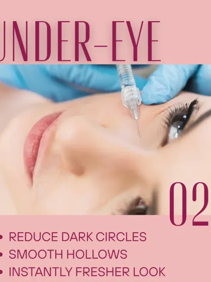Under-eye fillers are a game-changer for a tired look. By carefully placing filler in the tear trough area, I can reduce dark circles and smooth hollows for an instantly fresher appearance.