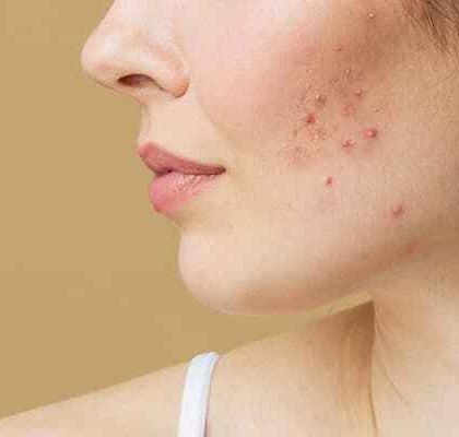 Priya J Talageri - Skin Resurfacing & Pigmentation Correction My Approach to Patient Education photo 13