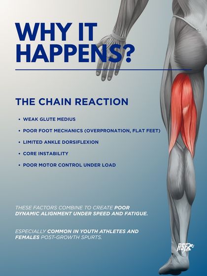 Why does knee valgus happen? This infographic explains the chain reaction of causes, including weak glute medius, poor foot mechanics, and core instability, which are especially common in youth and female athletes.