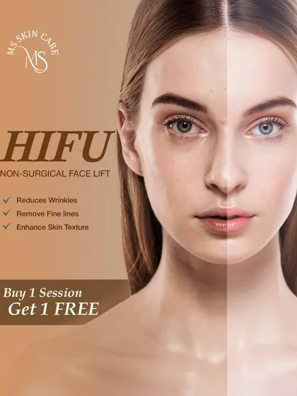 HIFU, or High-Intensity Focused Ultrasound, is my go-to for a non-surgical facelift. It effectively reduces wrinkles, removes fine lines, and enhances skin texture by tightening the deeper layers of the skin, giving you a lifted and more sculpted look.