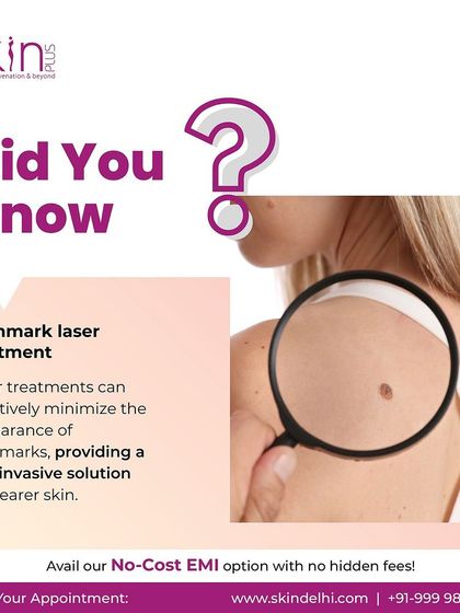 Laser Removal: Moles, Warts & Tags photo 7