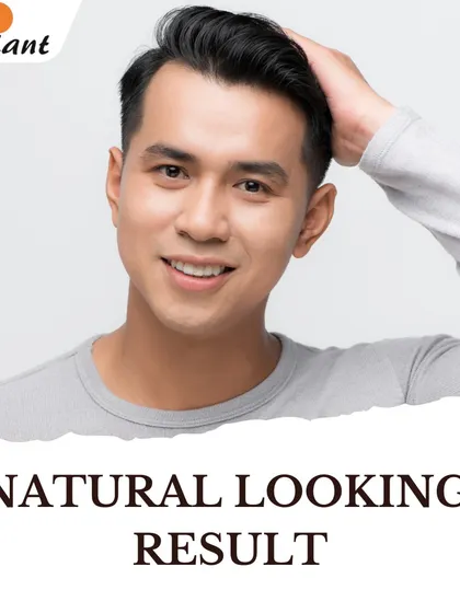 My primary goal is to create a result that looks completely natural. I meticulously plan the angle, direction, and density of each graft to mimic natural hair patterns, ensuring a seamless and undetectable outcome.