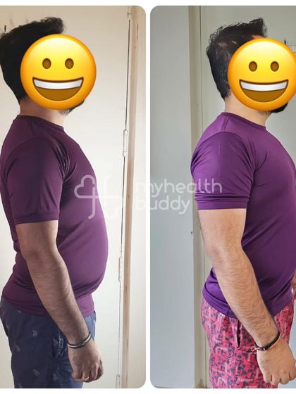 Another side view of Anshul's transformation.