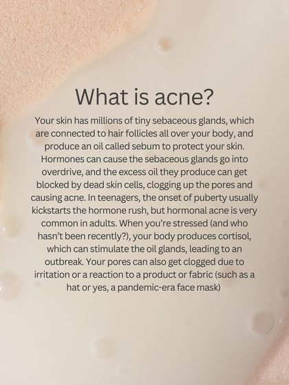 What causes acne? This educational post breaks down the roles of hormones, sebum, and bacteria in the formation of acne, from teenage breakouts to adult hormonal acne.
