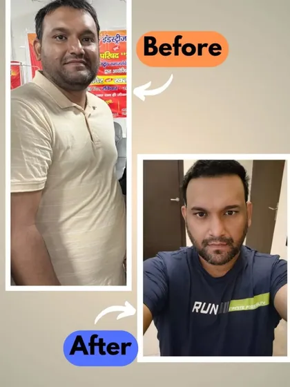 This is what sustainable change looks like. This transformation was achieved in just 3 months through a personalized diet plan focusing on fat loss, not just weight loss, using everyday kitchen ingredients.