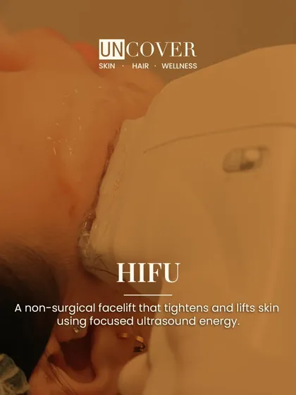 This is the HIFU device we use for our non-surgical facelift and skin tightening treatments. It delivers focused ultrasound energy to lift and tighten the skin from within, targeting the foundational layers.
