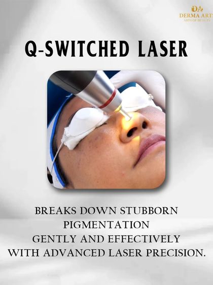 The Q-Switched Laser breaks down stubborn pigmentation gently and effectively, using advanced laser precision to target dark spots and melasma.