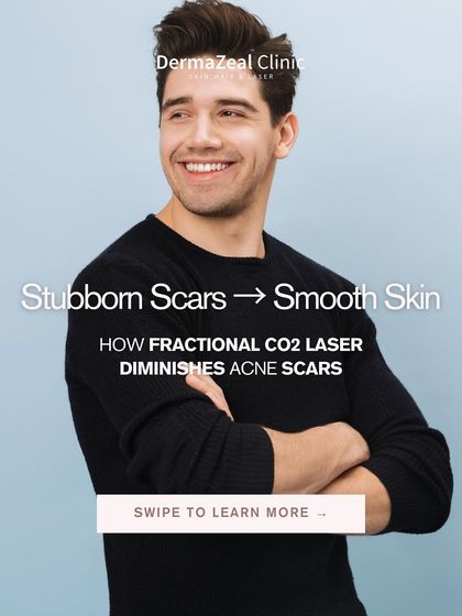 From stubborn scars to smooth skin, it is possible with Fractional CO2 Laser therapy. This treatment helps reduce scarring and brightens your complexion, giving you back your confidence.