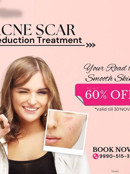 Don't let acne scars define your skin. With a flat 60% off offer on our acne scar reduction treatment, achieving smoother skin is more accessible. I use advanced lasers to ensure effective and safe results.