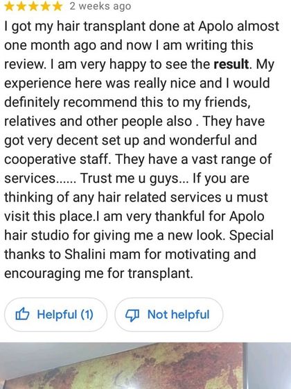 This client is very happy with the results just one month after his hair transplant. He highlights our wonderful staff, cooperative nature, and the new look that our team helped him achieve.
