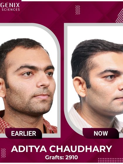 Sub-inspector Aditya Chaudhary explains how his undetectable transplant restored the confidence he needs in his line of duty.