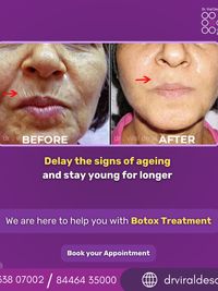 Injectables & Thread Lifts