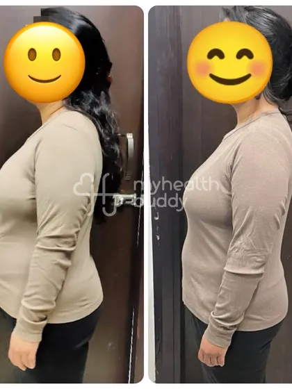 This client lost 9 kgs in 3 months. Her side profile shows a visible change in her posture and a reduction in abdominal size.