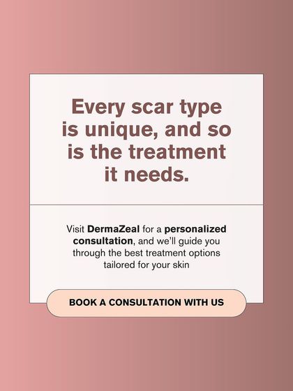 Because every scar type is unique, the treatment must be as well. A personalized consultation at my clinic will help determine the best course of action for your skin.