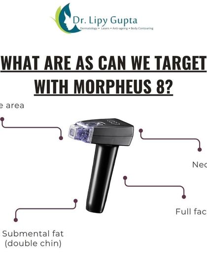 Morpheus8: Deep Skin Remodeling & Tightening photo 5