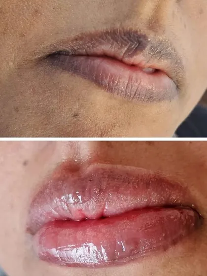 This is a great example of dark lip correction, one of my specialized services. The client had significant hyperpigmentation, which I carefully neutralized before applying a warm, rosy tint. The final look is bright, even-toned, and completely natural.