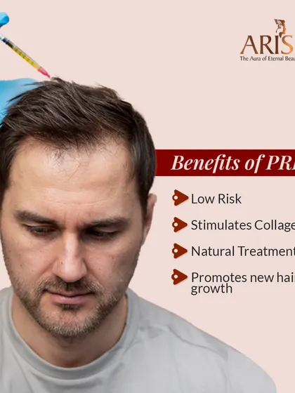 This image demonstrates the Platelet-Rich Plasma (PRP) procedure. It's a natural treatment where I use the growth factors from your own blood to stimulate collagen and promote new hair growth, making it a low-risk option for hair restoration.