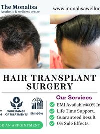 Hair Restoration Treatments