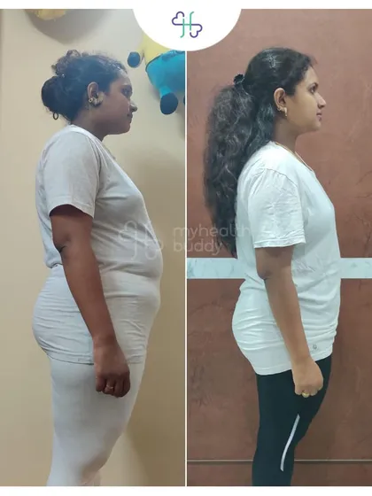 This is Ramya, who lost 6 kgs in 12 weeks after her pregnancy. She learned to manage her food habits and build an active lifestyle, and the results go beyond the scale, boosting her confidence.