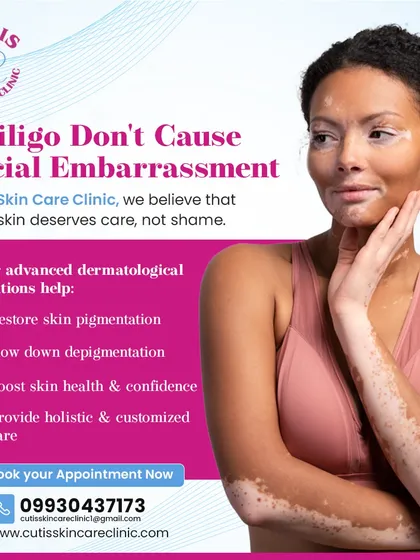 We believe vitiligo deserves care and understanding, not embarrassment. Our advanced dermatological solutions are designed to help restore skin pigmentation, slow down depigmentation, and provide holistic, customized care to boost our patients' skin health and confidence.