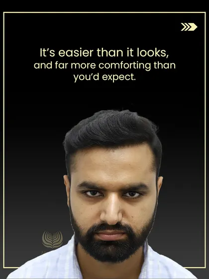 This is the result of a well-planned journey. It's not just about getting your hair back; it's about regaining the confidence to face the world. The process is more comfortable than you might think, and the results are predictable and natural.