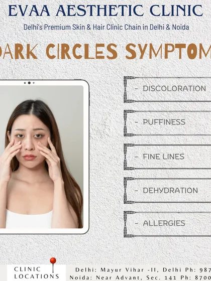 An educational graphic outlining the common symptoms associated with dark circles. These can include discoloration, puffiness, fine lines, and dehydration, all of which we can address at our clinic.
