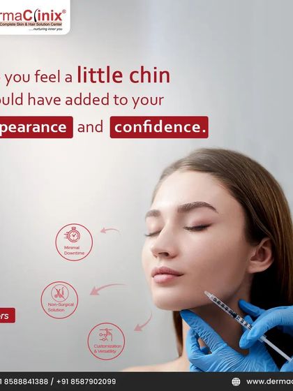 A visual explaining how fillers can be used for chin augmentation. This non-surgical solution enhances your profile and adds confidence with minimal downtime and customizable results.