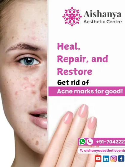 This graphic is a powerful reminder to heal, repair, and restore your skin. My treatments are designed not just to clear acne marks, but to improve the overall health and resilience of your skin.