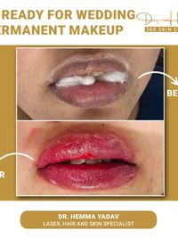 Cosmetic Injectables & Lifts