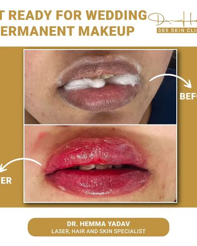 Cosmetic Injectables & Lifts