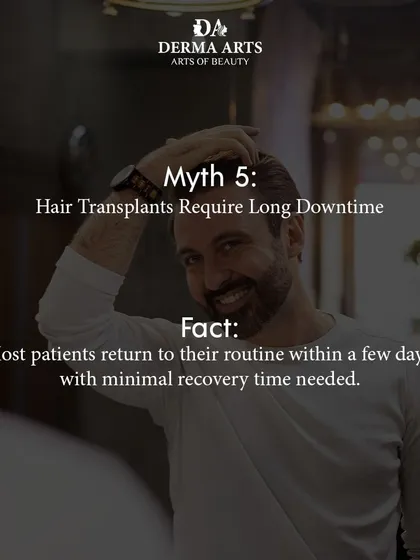 Myth: Hair transplants require long downtime. Fact: Most of my patients are able to return to their normal routine within just a few days. The recovery is quick, with minimal disruption to your life.